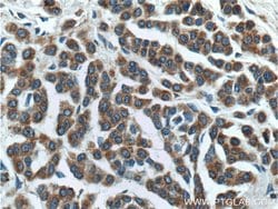 SILV Rabbit anti-Human, Polyclonal, Proteintech 150 &mu;L | Buy Online | Proteintech Group Inc | Fisher Scientific