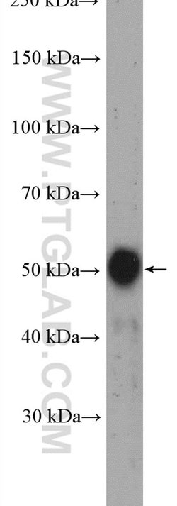 GLTSCR2 Rabbit anti-Human, Polyclonal, Proteintech:Antibodies:Primary Antibodies