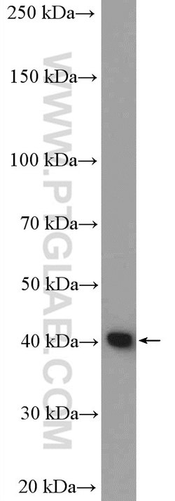 CYSLTR1 Rabbit anti-Human, Mouse, Rat, Polyclonal, Proteintech