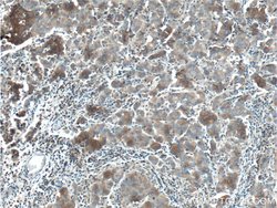 DVL1 Rabbit anti-Human, Mouse, Polyclonal, Proteintech 150 &mu;L; Unconjugated:Antibodies,