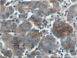 DVL1 Rabbit anti-Human, Mouse, Polyclonal, Proteintech 150 &mu;L; Unconjugated:Antibodies,