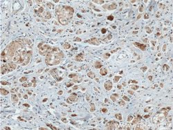 DVL1 Rabbit anti-Human, Mouse, Polyclonal, Proteintech 150 &mu;L; Unconjugated:Antibodies,