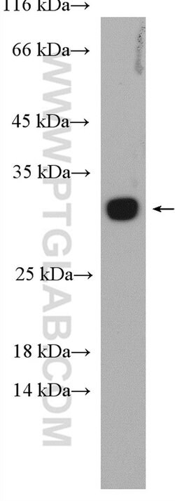RAB5B Rabbit anti-Human, Mouse, Polyclonal, Proteintech:Antibodies:Primary