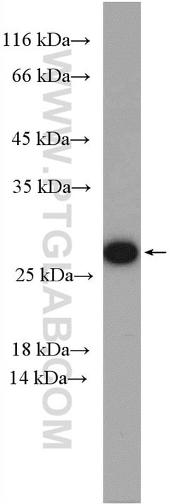 RAB5B Rabbit anti-Human, Mouse, Polyclonal, Proteintech:Antibodies:Primary