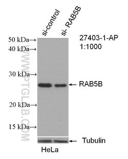 RAB5B Rabbit anti-Human, Mouse, Polyclonal, Proteintech:Antibodies:Primary