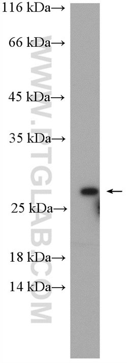 RAB5B Rabbit anti-Human, Mouse, Polyclonal, Proteintech:Antibodies:Primary