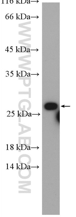 RAB5B Rabbit anti-Human, Mouse, Polyclonal, Proteintech:Antibodies:Primary