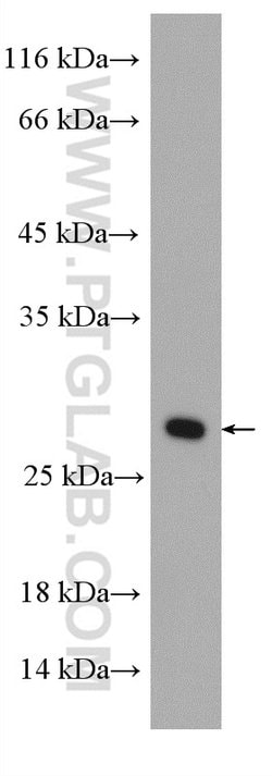 RAB5B Rabbit anti-Human, Mouse, Polyclonal, Proteintech:Antibodies:Primary