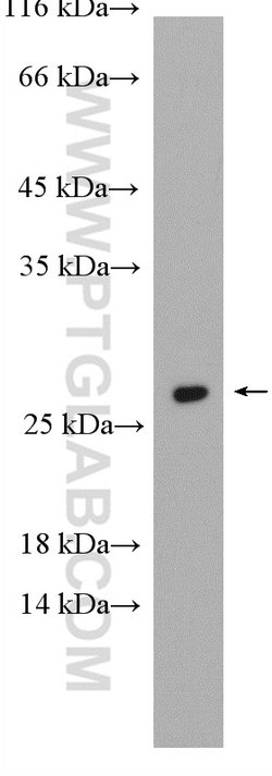 RAB5B Rabbit anti-Human, Mouse, Polyclonal, Proteintech:Antibodies:Primary