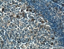 TSEPA Rabbit anti-Human, Mouse, Polyclonal, Proteintech 150 &mu;L; Unconjugated:Antibodies,