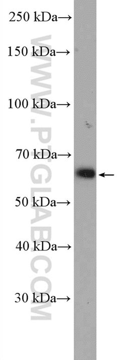 TRIM8 Rabbit anti-Human, Polyclonal, Proteintech 150 &mu;L; Unconjugated:Antibodies,