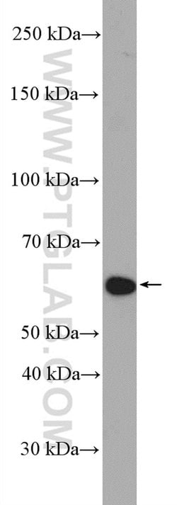 TRIM8 Rabbit anti-Human, Polyclonal, Proteintech 150 &mu;L; Unconjugated:Antibodies,