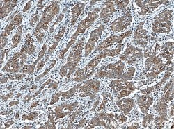 ATG4A Rabbit anti-Human, Mouse, Polyclonal, Proteintech:Antibodies:Primary