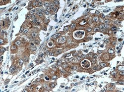 ATG4A Rabbit anti-Human, Mouse, Polyclonal, Proteintech:Antibodies:Primary
