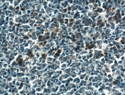 PDXP Rabbit anti-Human, Mouse, Polyclonal, Proteintech 150 &mu;L; Unconjugated:Antibodies,