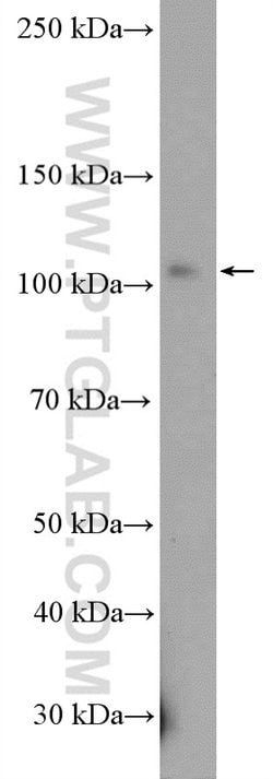 DHTKD1 Rabbit anti-Human, Polyclonal, Proteintech 150 &mu;L; Unconjugated:Antibodies,