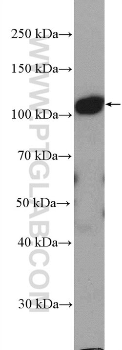 DHTKD1 Rabbit anti-Human, Polyclonal, Proteintech 150 &mu;L; Unconjugated:Antibodies,