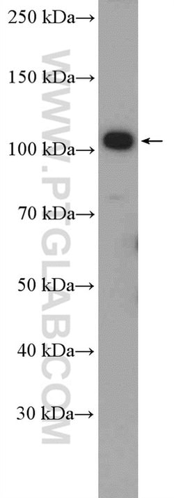 DHTKD1 Rabbit anti-Human, Polyclonal, Proteintech 150 &mu;L; Unconjugated:Antibodies,