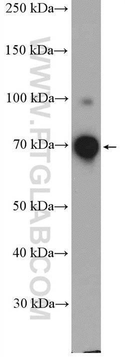 DDX41 Rabbit anti-Human, Mouse, Polyclonal, Proteintech:Antibodies:Primary