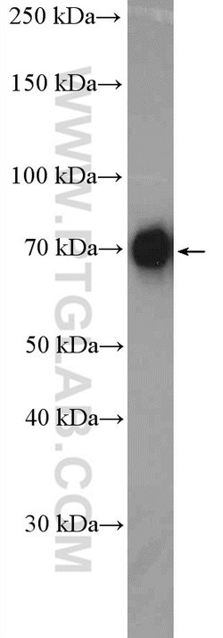 DDX41 Rabbit anti-Human, Mouse, Polyclonal, Proteintech:Antibodies:Primary