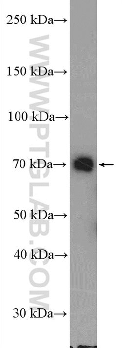 DDX41 Rabbit anti-Human, Mouse, Polyclonal, Proteintech:Antibodies:Primary