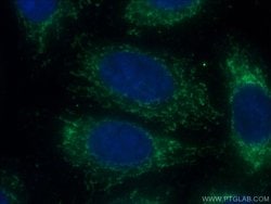 Interferon beta Rabbit anti-Human, Polyclonal, Proteintech 150 &mu;L; Unconjugated:Antibodies,
