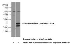 Interferon beta Rabbit anti-Human, Polyclonal, Proteintech 150 &mu;L; Unconjugated:Antibodies,