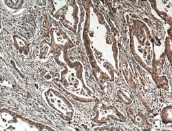 IRE1/ERN1 Rabbit anti-Human, Polyclonal, Proteintech:Antibodies:Primary