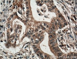 IRE1/ERN1 Rabbit anti-Human, Polyclonal, Proteintech:Antibodies:Primary