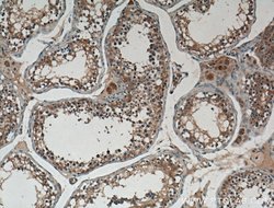 IRE1/ERN1 Rabbit anti-Human, Polyclonal, Proteintech:Antibodies:Primary