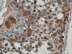 IRE1/ERN1 Rabbit anti-Human, Polyclonal, Proteintech:Antibodies:Primary