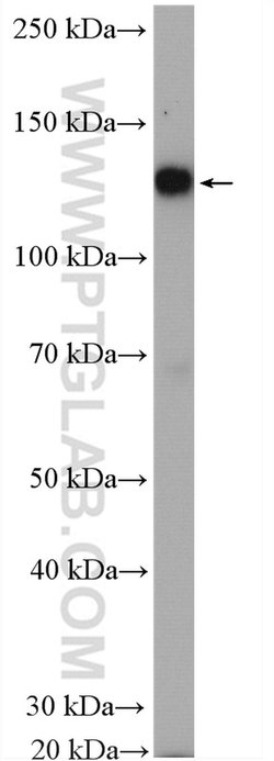 IRE1/ERN1 Rabbit anti-Human, Polyclonal, Proteintech:Antibodies:Primary