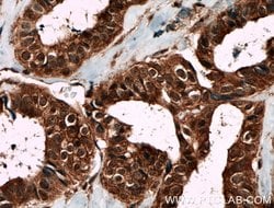 Livin Rabbit anti-Human, Polyclonal, Proteintech 150 &mu;L | Buy Online | Proteintech Group Inc | Fisher Scientific