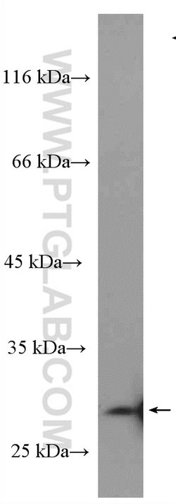 Livin Rabbit anti-Human, Polyclonal, Proteintech 150 &mu;L | Buy Online | Proteintech Group Inc | Fisher Scientific