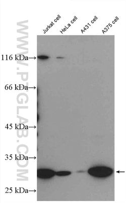 Livin Rabbit anti-Human, Polyclonal, Proteintech 150 &mu;L | Buy Online | Proteintech Group Inc | Fisher Scientific