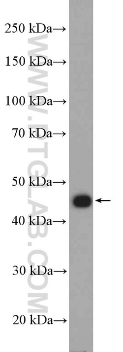 AKD2 Rabbit anti-Human, Polyclonal, Proteintech 150 &mu;L; Unconjugated:Antibodies,