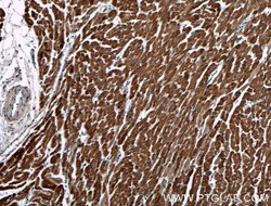 AKD2 Rabbit anti-Human, Polyclonal, Proteintech 150 &mu;L; Unconjugated:Antibodies,