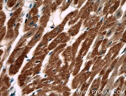 AKD2 Rabbit anti-Human, Polyclonal, Proteintech 150 &mu;L; Unconjugated:Antibodies,