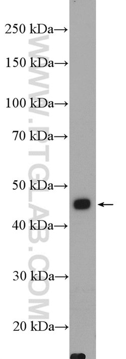 AKD2 Rabbit anti-Human, Polyclonal, Proteintech 150 &mu;L; Unconjugated:Antibodies,