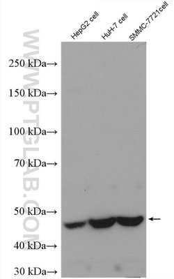 AKD2 Rabbit anti-Human, Polyclonal, Proteintech 150 &mu;L; Unconjugated:Antibodies,
