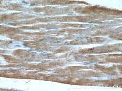 Calsequestrin 2 Rabbit anti-Human, Mouse, Polyclonal, Proteintech 20 &mu;L;