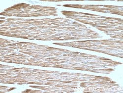 Calsequestrin 2 Rabbit anti-Human, Mouse, Polyclonal, Proteintech 20 &mu;L;