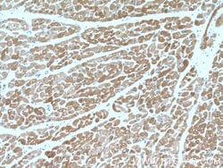 Calsequestrin 2 Rabbit anti-Human, Mouse, Polyclonal, Proteintech 20 &mu;L;