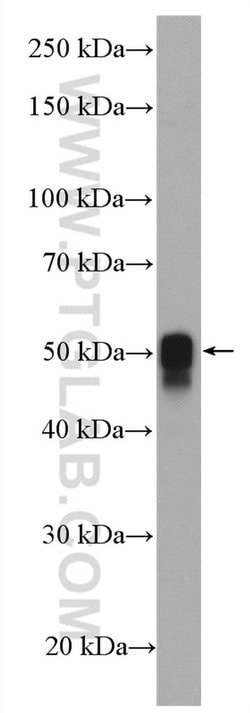 Calsequestrin 2 Rabbit anti-Human, Mouse, Polyclonal, Proteintech 20 &mu;L;