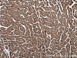 RYR2 Rabbit anti-Human, Polyclonal, Proteintech 150 &mu;L | Buy Online | Proteintech Group Inc | Fisher Scientific