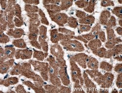 RYR2 Rabbit anti-Human, Polyclonal, Proteintech 150 &mu;L | Buy Online | Proteintech Group Inc | Fisher Scientific
