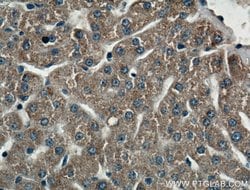CIDEB Rabbit anti-Human, Polyclonal, Proteintech:Antibodies:Primary Antibodies