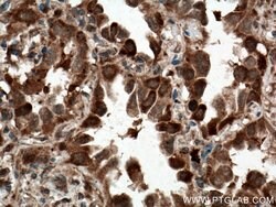 C21orf2 Rabbit anti-Human, Polyclonal, Proteintech 150 &mu;L; Unconjugated:Antibodies,