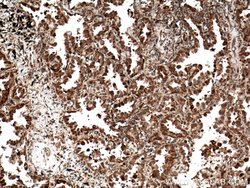 C21orf2 Rabbit anti-Human, Polyclonal, Proteintech 150 &mu;L; Unconjugated:Antibodies,