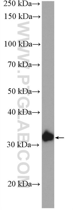 C21orf2 Rabbit anti-Human, Polyclonal, Proteintech 150 &mu;L; Unconjugated:Antibodies,